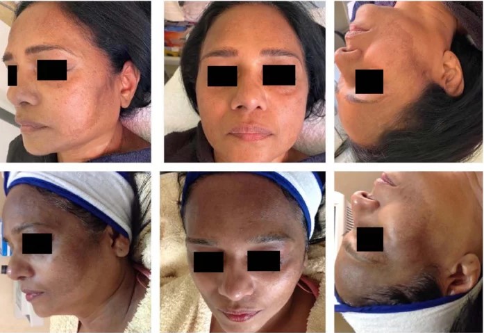 Before_After3Months-510x754